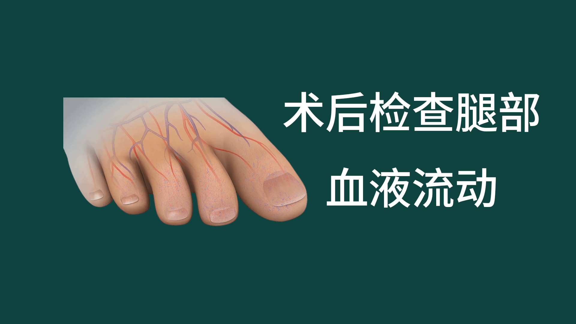 手術后如何檢查腿部的血液流動