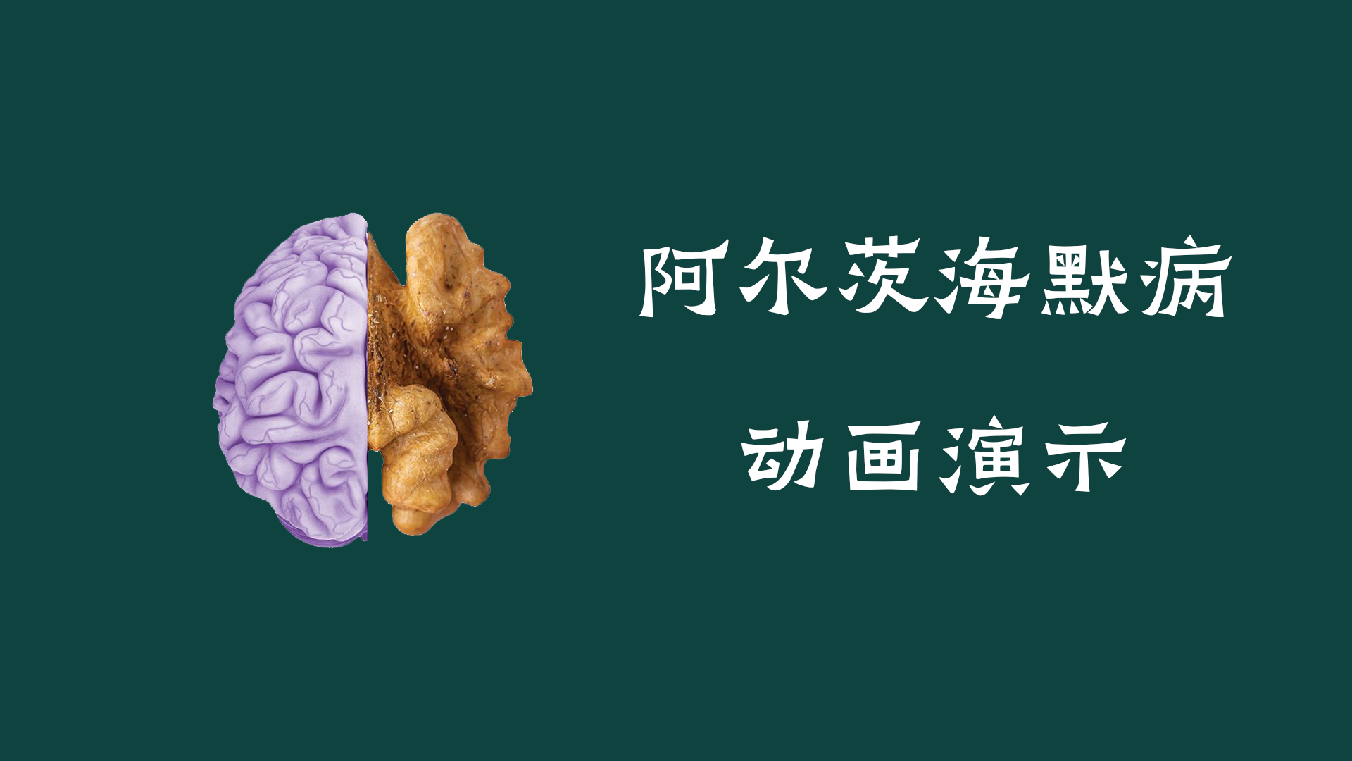 阿爾茨海默病