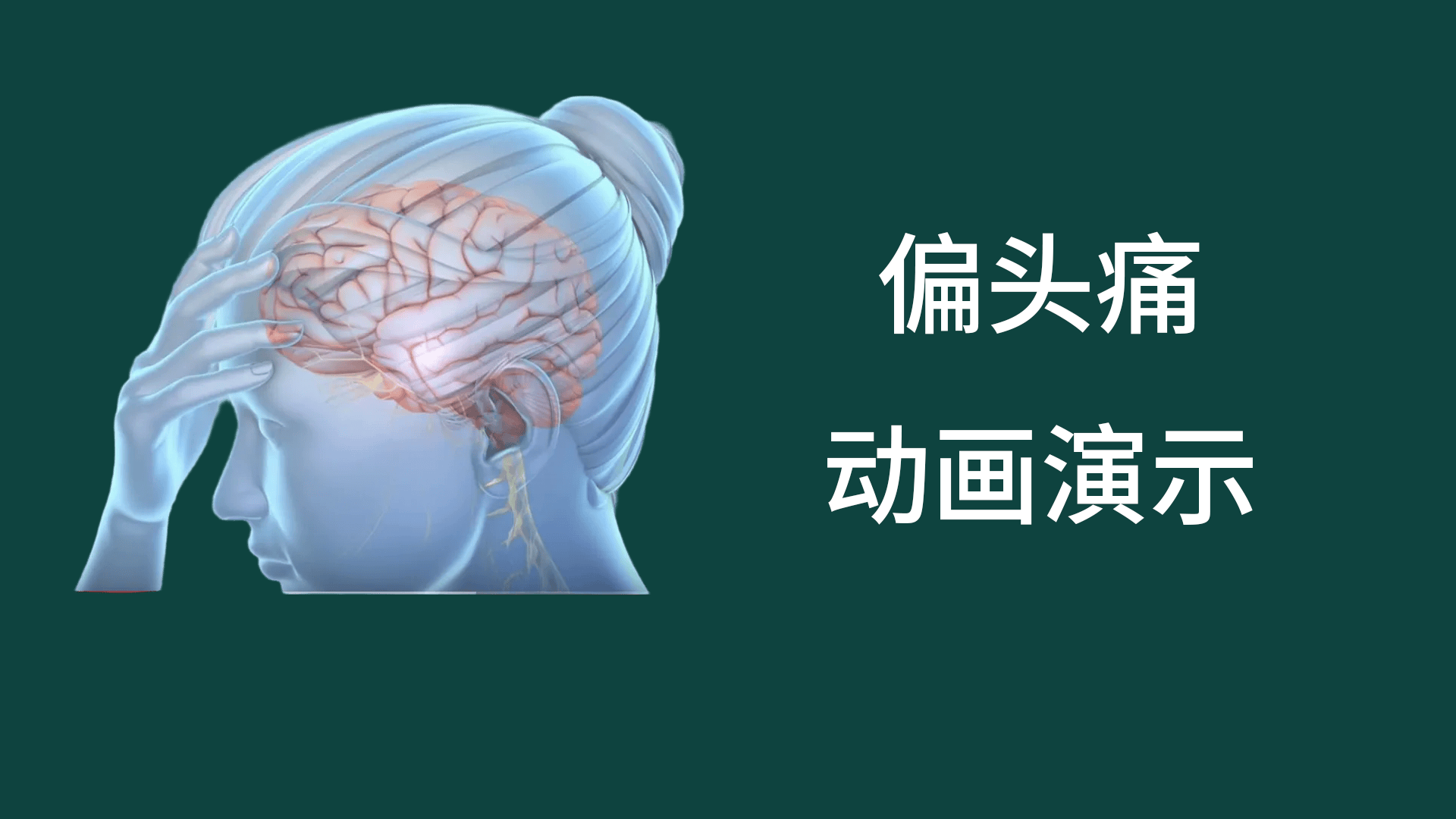 偏頭痛