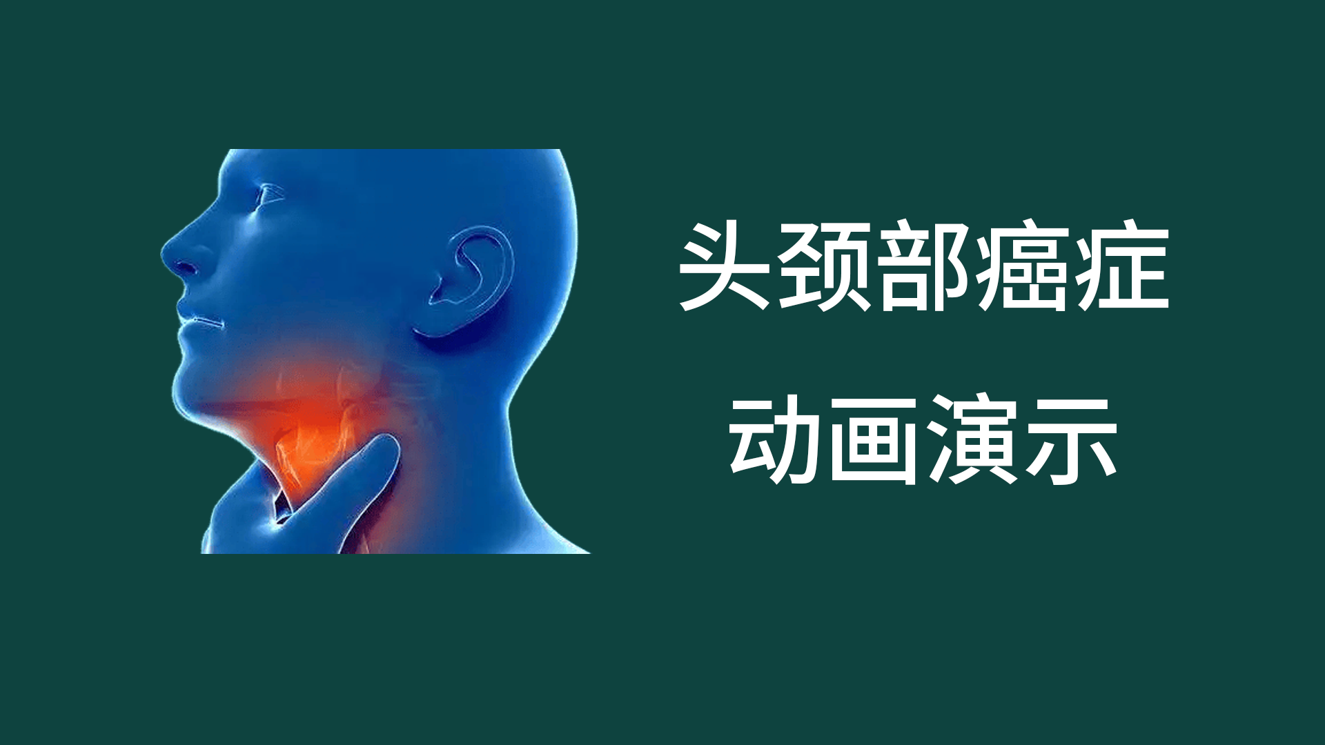 頭頸癌