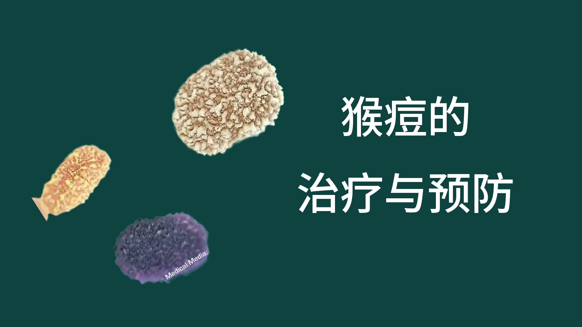 猴痘