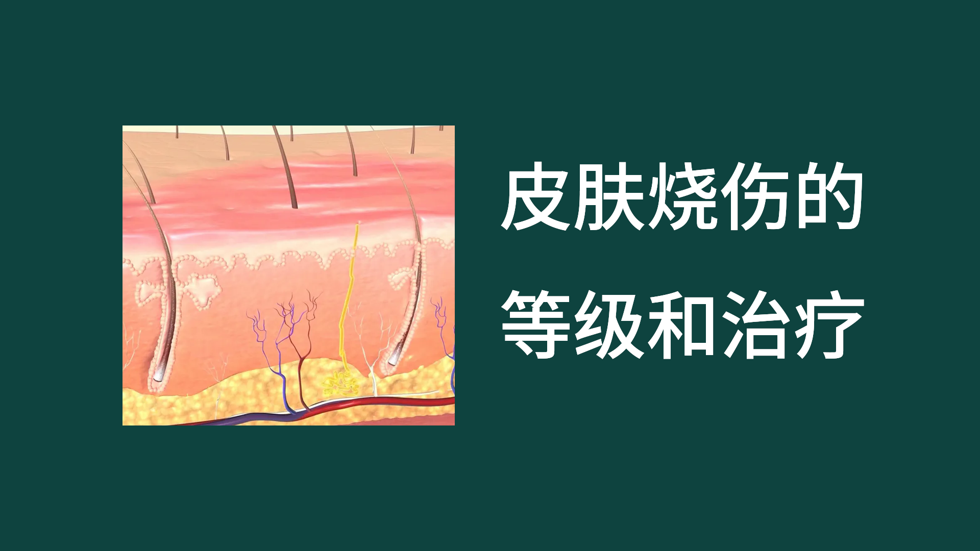 皮膚燒傷