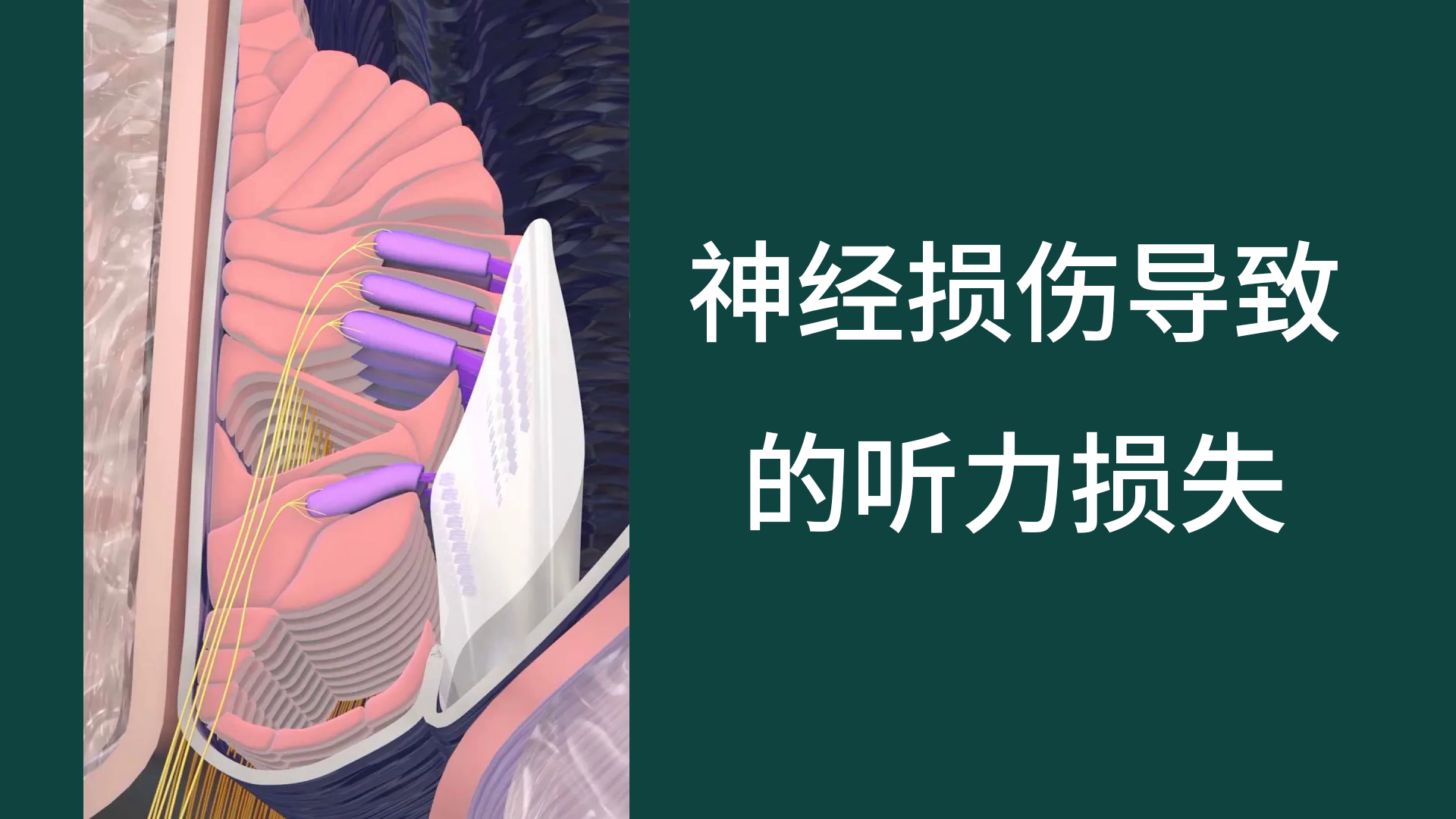 神經損傷導致的聽力損失